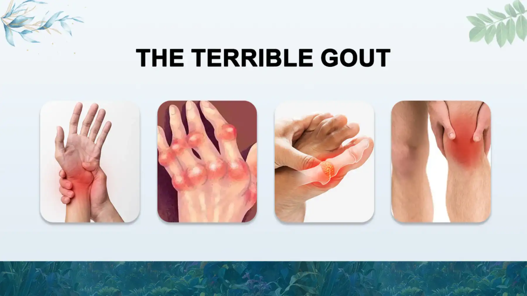 Several locations where gout can occur Several locations where gout can occur