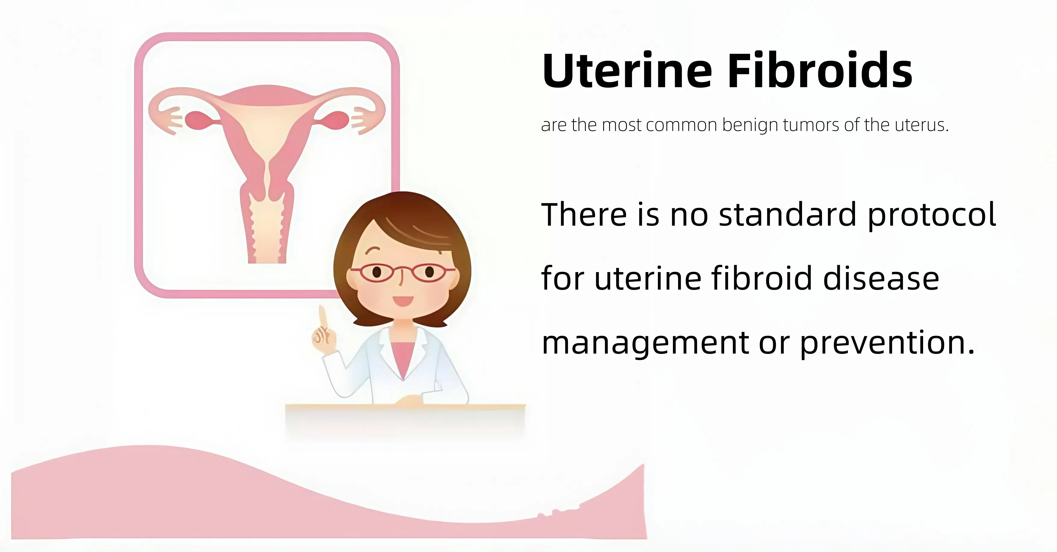 What is uterine fibroid