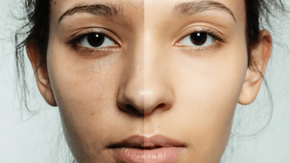 Comparison between dull skin and normal skin Comparison between dull skin and normal skin